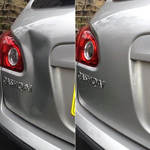 Dent Removal Service